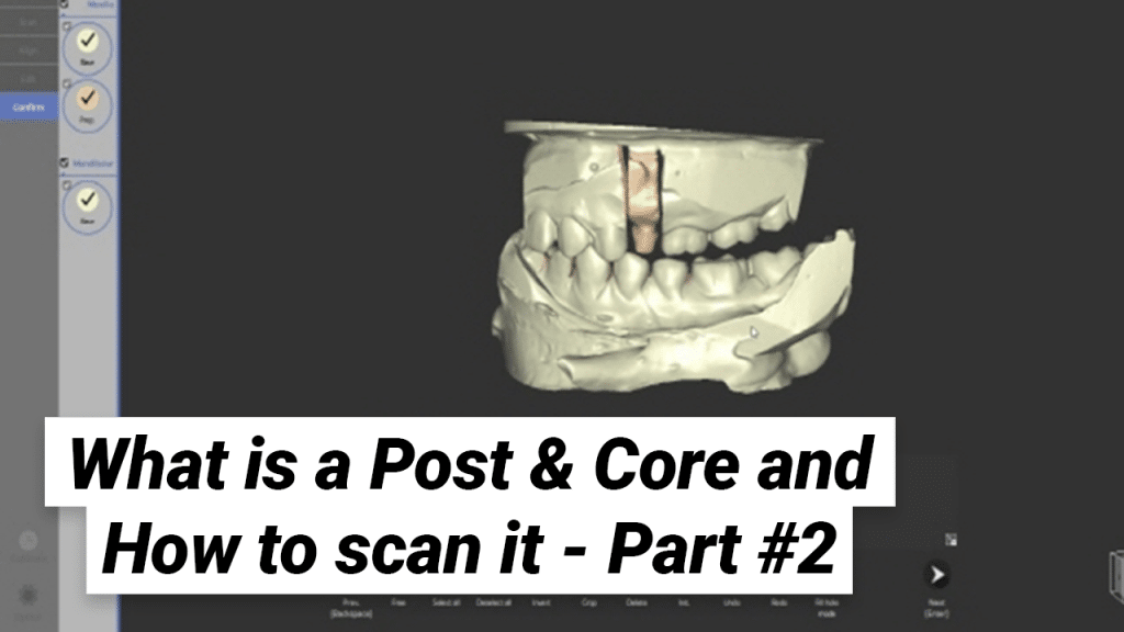 Post &amp; Core là gì và cách quét nó - Phần 2