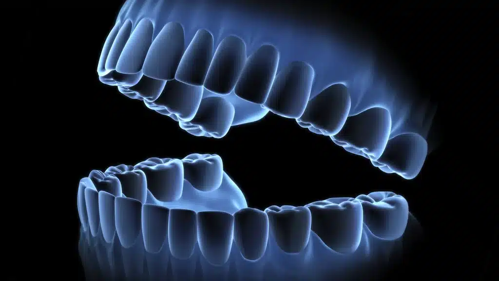 Teeth Model