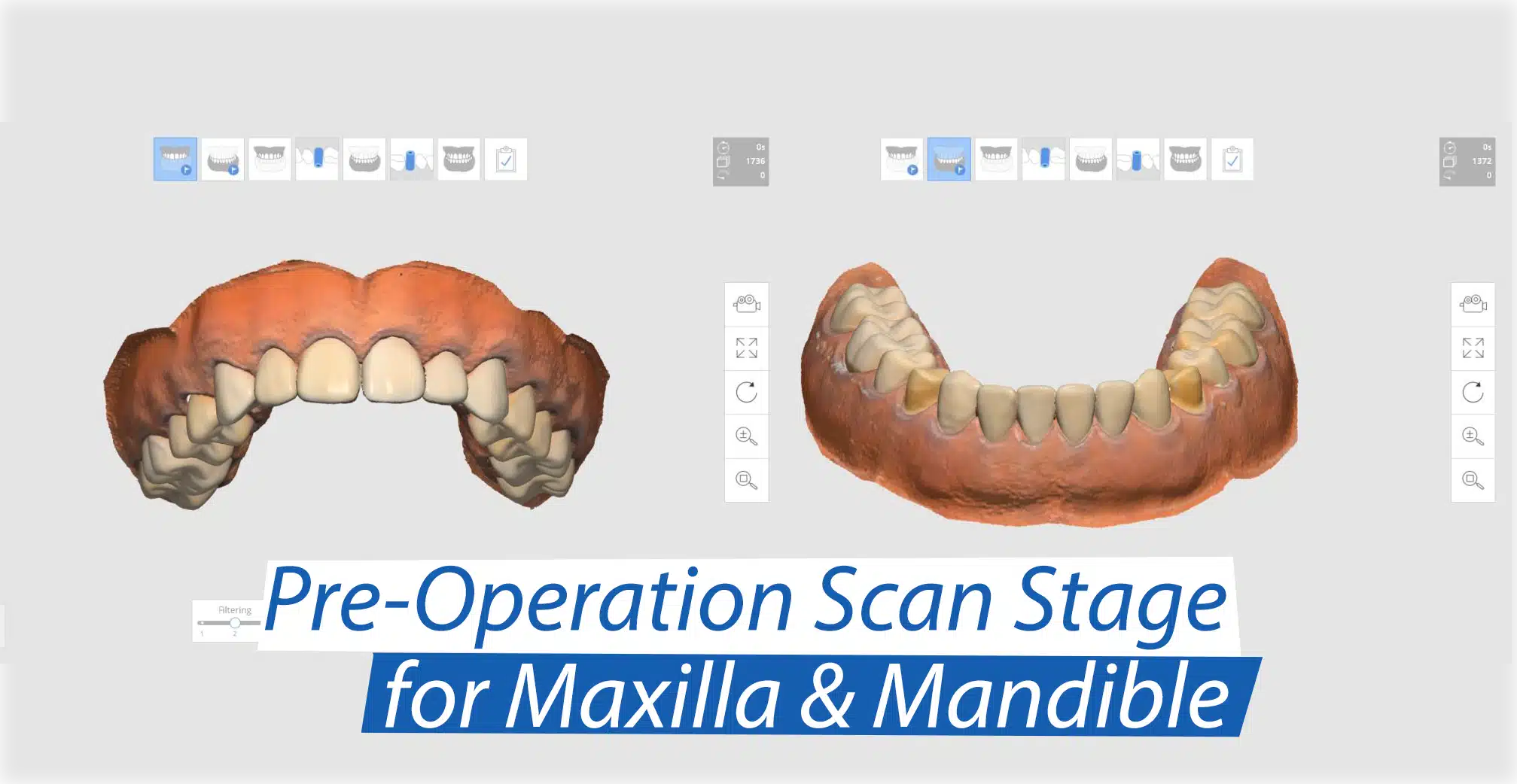New Iscan Function: Pre-operation Scan Stage