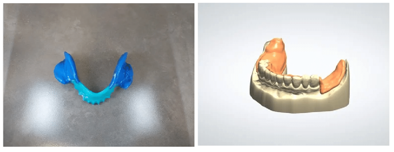 Newsletter_image_June 2023_Edition1 _ Scanning a PVS Impression_1@2x