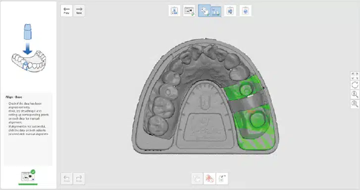 Auto-alignment with base prep