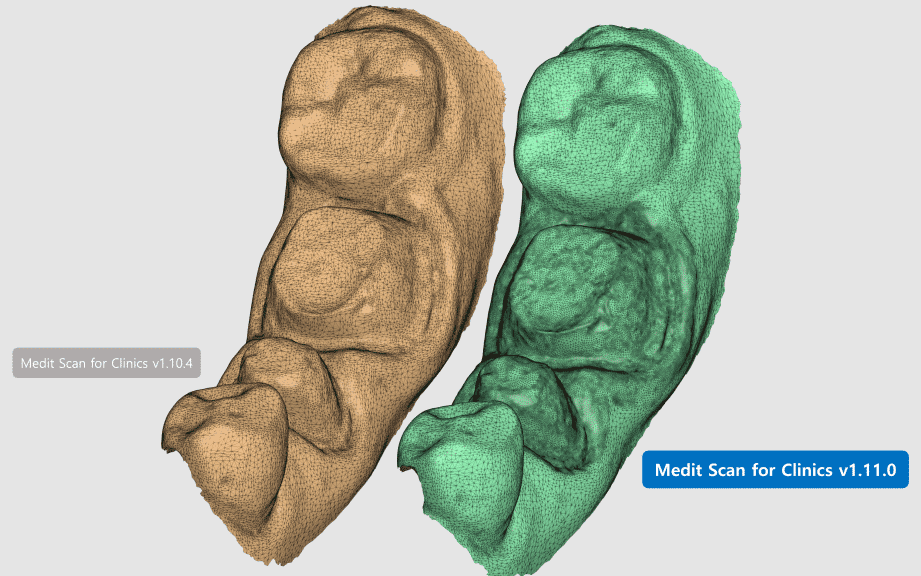 Release Note_medit Scan for Clinics V1.11.0