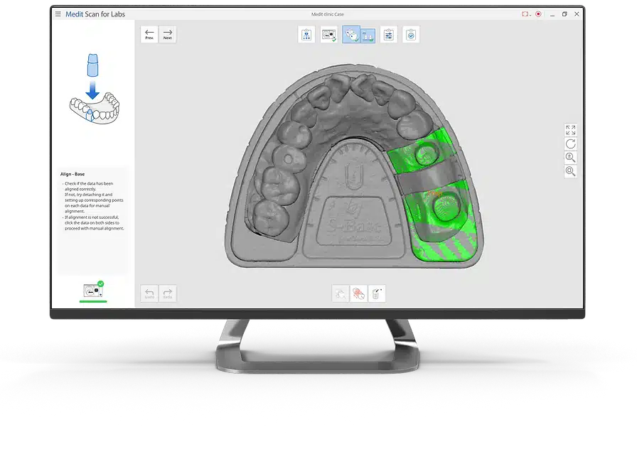 Medit Scan for Labs I Auto-align