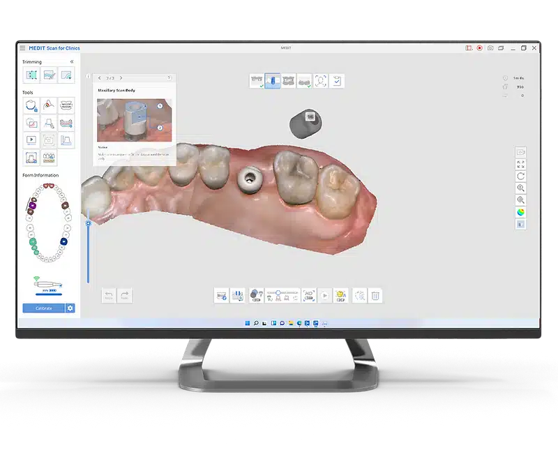 Medit Scan for Clinics I Ai Scan Body Matching