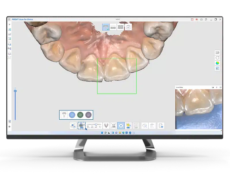 Medit Scan for Clinics I Smart Color Filtering