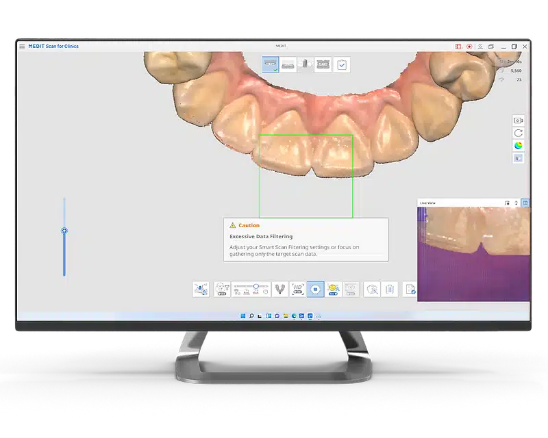 Medit Scan for Clinics I Smart Scan Guide