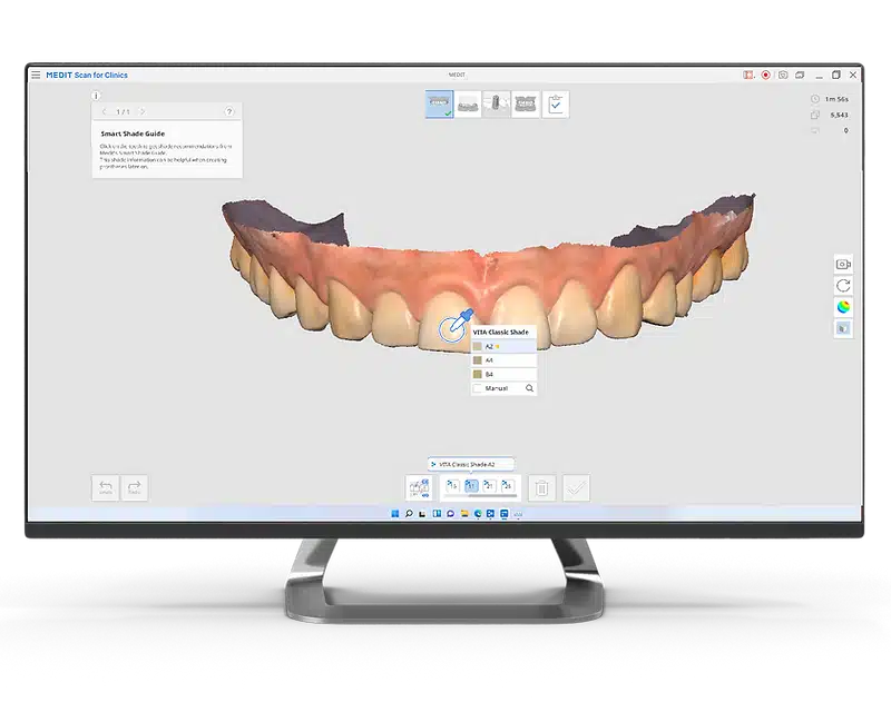 Medit Scan for Clinics I Smart Shade Guide