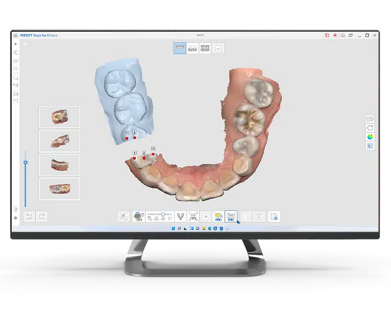 Medit Scan for Clinics I Smart Stitching