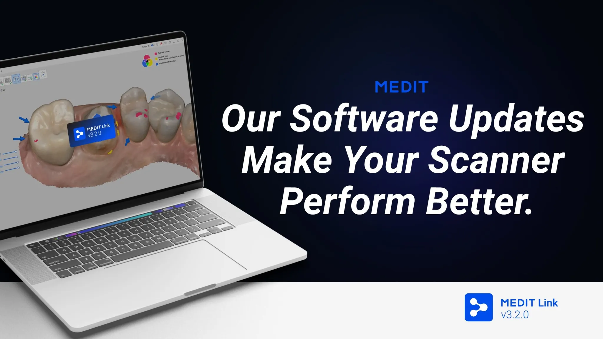 Medit Link v3.2.0: Our software updates make your scanner perform better