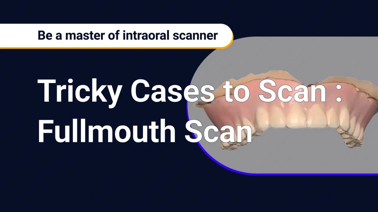 Tricky Cases to Scan – Fullmouth Scan