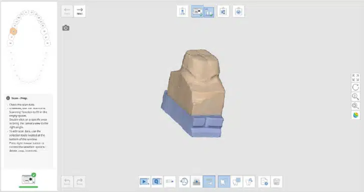 Medit Scan for Labs I HD mode for selected stages