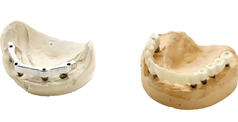 Medit Scan for Labs I Implant case scanning