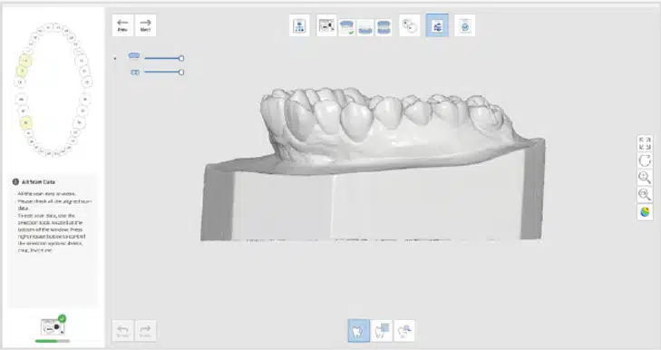 Medit Scan for Labs I Interproximal area scan