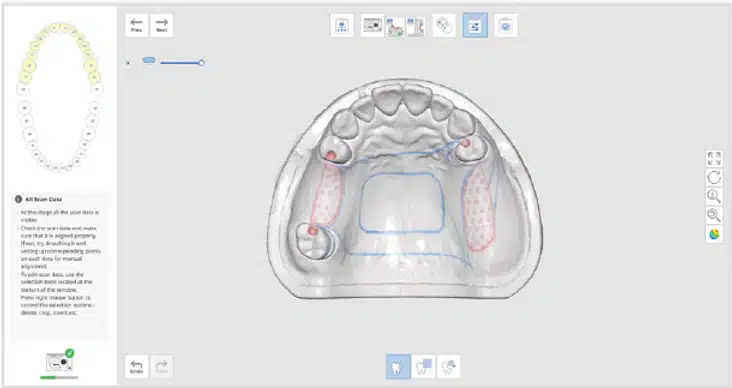 Medit Scan for Labs I Partial denture