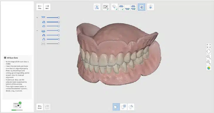 Medit Scan for Labs I Replica dentures