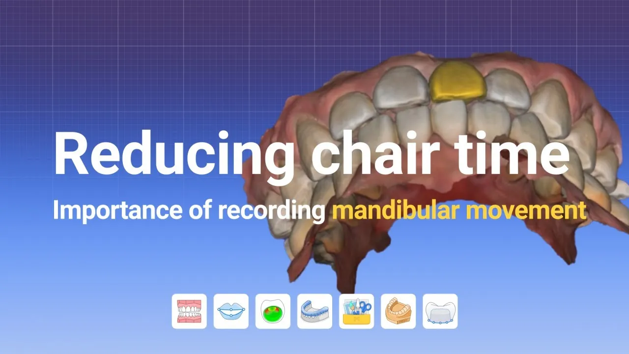 Reducing chair time: Importance of recording mandibular movement