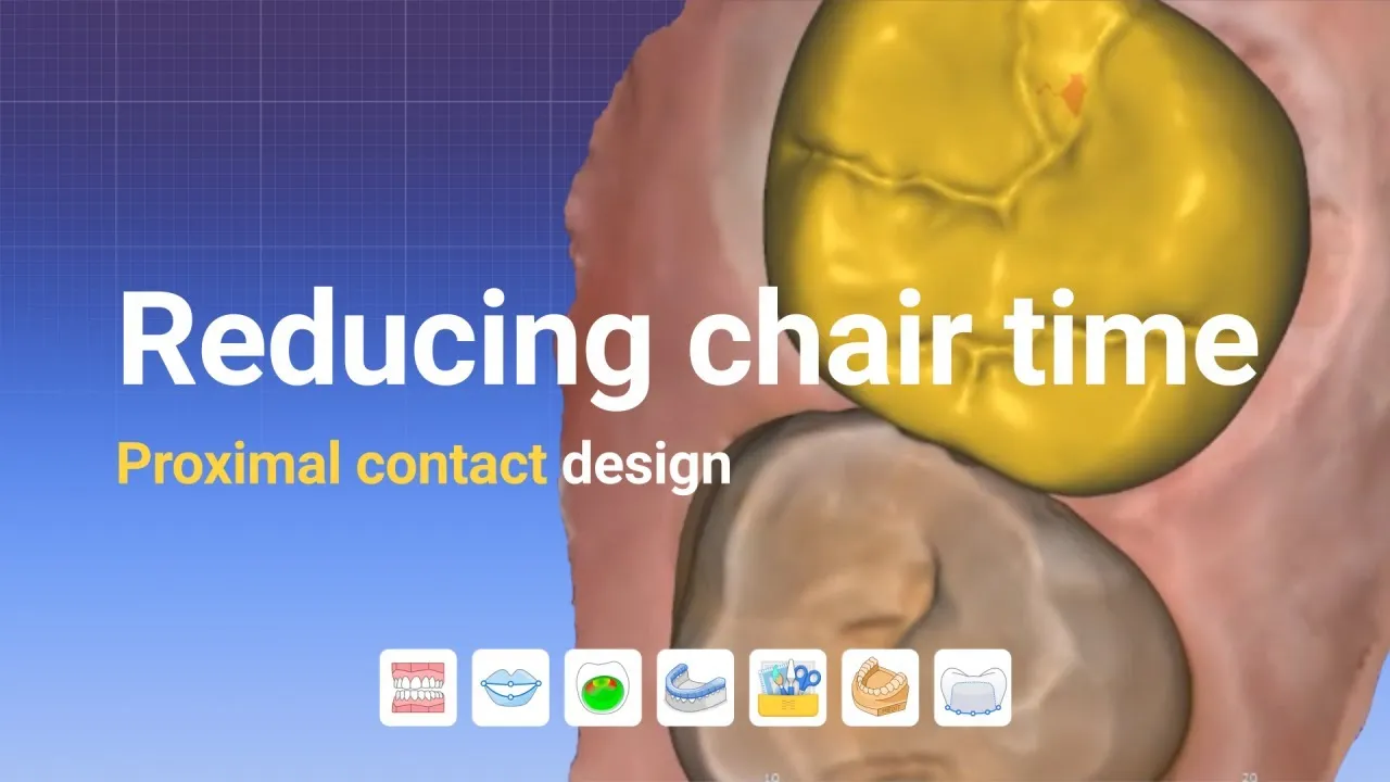 Reducing chair time: Key insights into proximal contact design