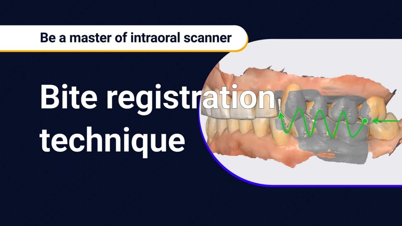 Bite Registration with Medit Scan for Clinics A Practical Guide