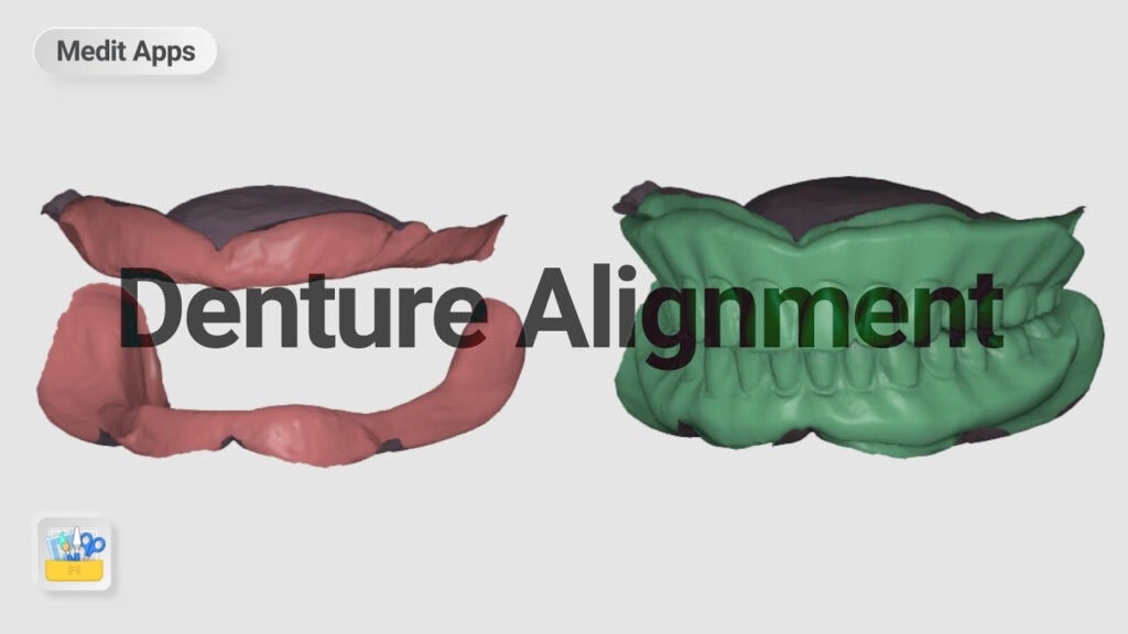 Aligning Edentulous and Denture Scan Data with the Medit Design App