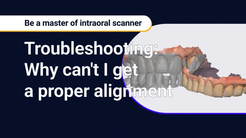 Solving Common Problems in Bite Scan Alignment: Incomplete Bite Scans