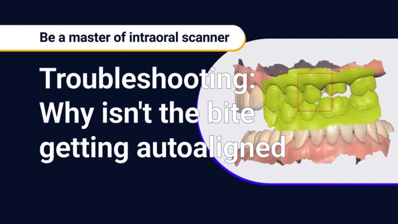 Solving Common Problems in Bite Scan Alignment: Incorrect Bite