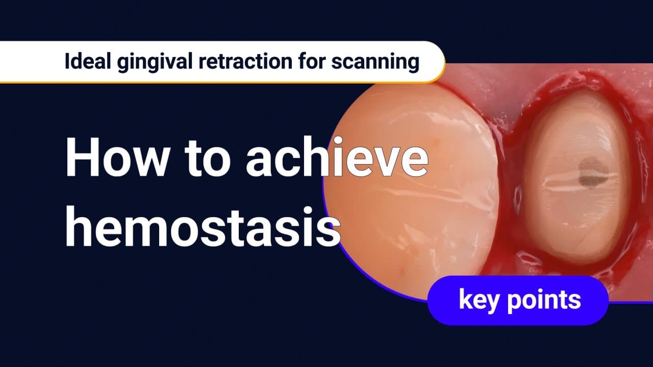 Achieving Hemostasis with Retraction Cord
