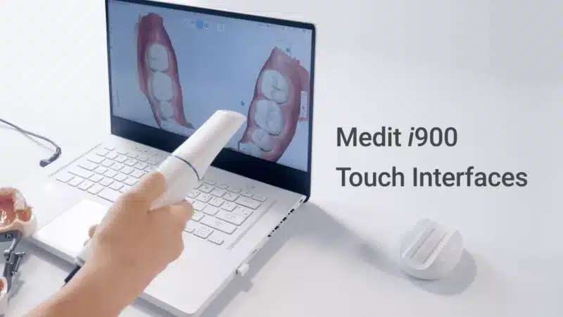 Exploring the Touch Interface of the Medit I900 Intraoral Scanner