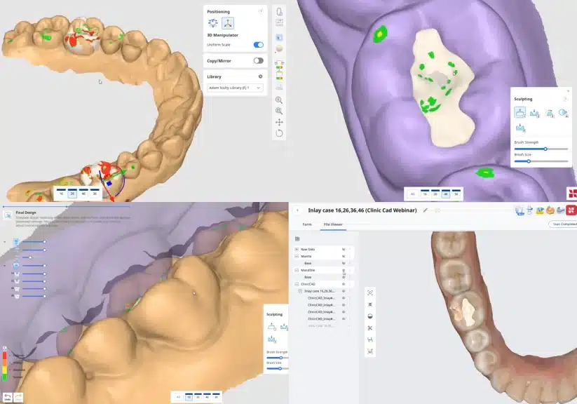 Medit Cliniccad_caso2_finale