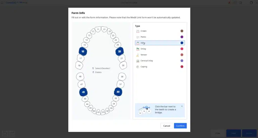 Medit Cliniccad_case2_setup