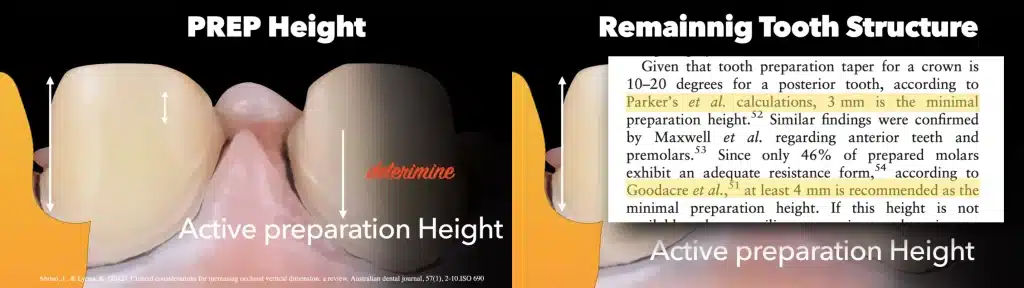 Prep Tips for Digital Impression_prep Height
