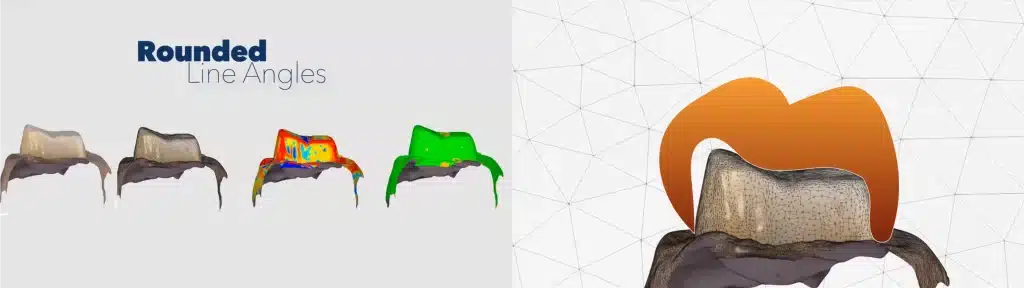 Prep Tips for Digital Impression_rounded Line Angles