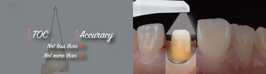 Prep Tips for Digital Impression_toc