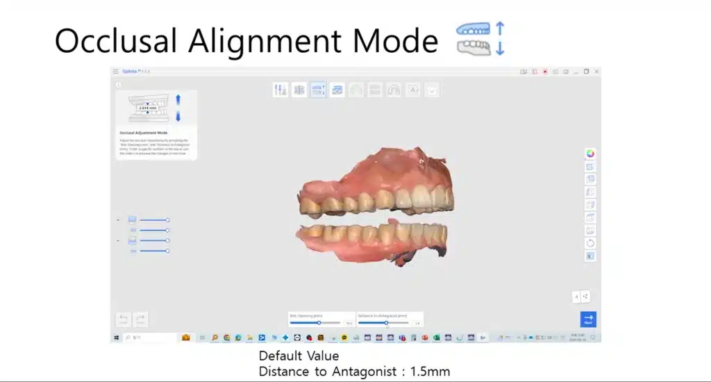 Design Occlusal Adjustment Mode