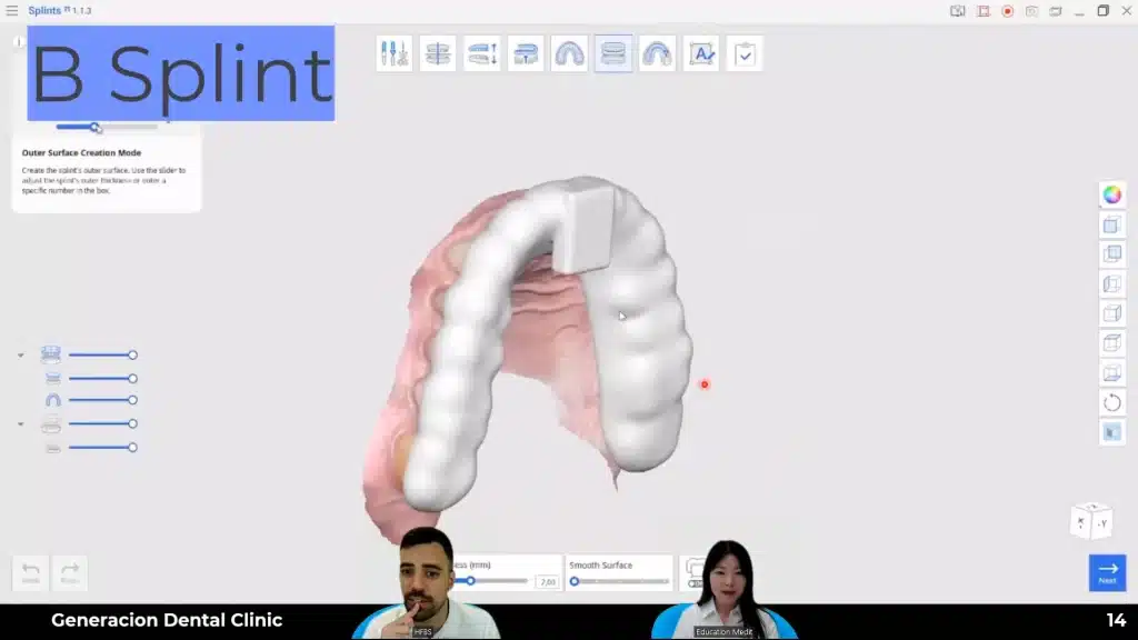 Types of Splints for Deprogramming_b Splint
