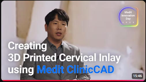 Tạo miếng ghép cổ tử cung in 3D