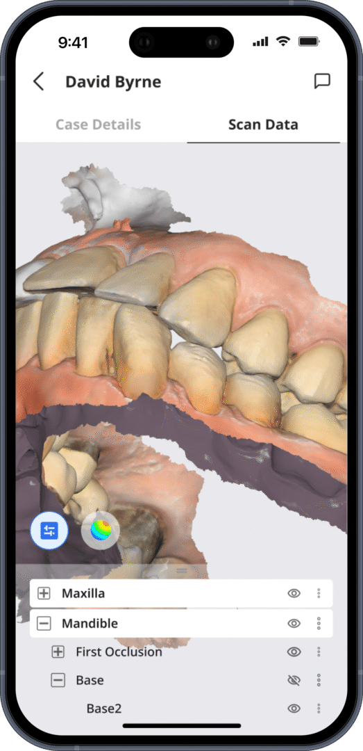 Pantalla de una aplicación móvil que muestra un modelo dental en 3D de los dientes superiores e inferiores (maxilar superior y mandíbula) con una lista de capas de las partes dentales.