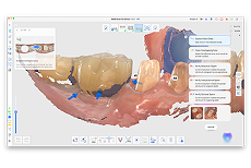 CAD 소프트웨어에서 상하악 치아의 3D 치과 모델로, 주석 팝업과 UI 도구가 표시된 모습.