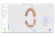 도구 모음이 표시된 치과 CAD 소프트웨어에서 보이는 상악 및 하악 치열의 3D 치과 모델.